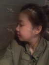 It was my dream to have a perfect face... — Korea cost, reviews & before-after | MISOODA
