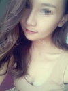 Convex Mouth Correction + V-line Reshaping — Korea cost, reviews & before-after | MISOODA