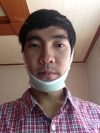 I want to be more gentle visually... — Korea cost, reviews & before-after | MISOODA