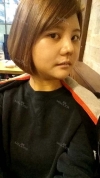 Cheekbone Reduction+ Mini V-line+ T.O.P Rrhinoplasty — Korea cost, reviews & before-after | MISOODA