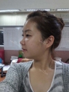 It was my dream to have a perfect face... — Korea cost, reviews & before-after | MISOODA