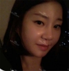 It was my dream to have a perfect face... — Korea cost, reviews & before-after | MISOODA