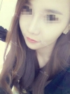 Convex Mouth Correction + V-line Reshaping — Korea cost, reviews & before-after | MISOODA