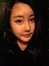 It was my dream to have a nice face since childhood... — Korea cost, reviews & before-after | MISOODA