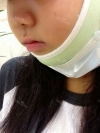 I had eager for a nice face since I was a little girl. — Korea cost, reviews & before-after | MISOODA