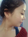 It was my dream to have a perfect face... — Korea cost, reviews & before-after | MISOODA