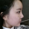It was my dream to have a nice face since childhood... — Korea cost, reviews & before-after | MISOODA
