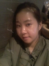 It was my dream to have a perfect face... — Korea cost, reviews & before-after | MISOODA