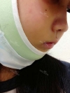 I had eager for a nice face since I was a little girl. — Korea cost, reviews & before-after | MISOODA