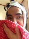 I want to be more gentle visually... — Korea cost, reviews & before-after | MISOODA