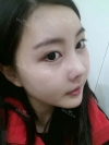 It was my dream to have a nice face since childhood... — Korea cost, reviews & before-after | MISOODA