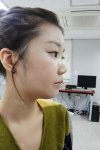 It was my dream to have a perfect face... — Korea cost, reviews & before-after | MISOODA