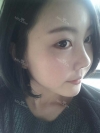 It was my dream to have a nice face since childhood... — Korea cost, reviews & before-after | MISOODA