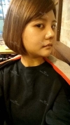 Cheekbone Reduction+ Mini V-line+ T.O.P Rrhinoplasty — Korea cost, reviews & before-after | MISOODA