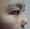 It was my dream to have a nice face since childhood... — Korea cost, reviews & before-after | MISOODA