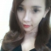 Convex Mouth Correction + V-line Reshaping — Korea cost, reviews & before-after | MISOODA