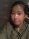 It was my dream to have a perfect face... — Korea cost, reviews & before-after | MISOODA