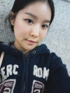 Cheekbone reduction + Natural Mini V-line — Korea cost, reviews & before-after | MISOODA