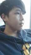 NANO Bimaxillary Diorthosis + Natural Mini V-line Reshaping+ Cheekbones Reduction + Eye reshaping — Korea cost, reviews & before-after | MISOODA