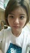Cheekbone Reduction+ Mini V-line+ T.O.P Rrhinoplasty — Korea cost, reviews & before-after | MISOODA