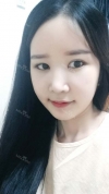 It's already been a year since I had the surgery~ — Korea cost, reviews & before-after | MISOODA