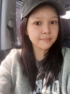 fg (forehead, zygoma), ni (fat), rhino (using donated cartilage and if more is needed ear cartilage) — Korea cost, reviews & before-after | MISOODA