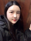 Ar + Zy + T + LP (jaw line) + thread lifting + (tack) Rhino (re) — Korea cost, reviews & before-after | MISOODA