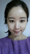 It's already been a year since I had the surgery~ — Korea cost, reviews & before-after | MISOODA
