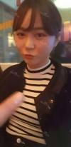 Ar + Zy + T / long hair + forehead / sil + epi + Rhino — Korea cost, reviews & before-after | MISOODA