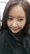 It's already been a year since I had the surgery~ — Korea cost, reviews & before-after | MISOODA