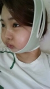 Ar + Zy + T / length extension — Korea cost, reviews & before-after | MISOODA