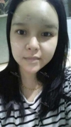 fg (forehead, zygoma), ni (fat), rhino (using donated cartilage and if more is needed ear cartilage) — Korea cost, reviews & before-after | MISOODA