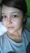 fg (forehead, zygoma), ni (fat), rhino (using donated cartilage and if more is needed ear cartilage) — Korea cost, reviews & before-after | MISOODA