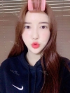 Ar + Zy + T + LP (jaw line) + thread lifting + (tack) Rhino (re) — Korea cost, reviews & before-after | MISOODA