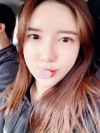 Ar + Zy + T + LP (jaw line) + thread lifting + (tack) Rhino (re) — Korea cost, reviews & before-after | MISOODA