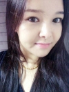 fg (forehead, zygoma), ni (fat), rhino (using donated cartilage and if more is needed ear cartilage) — Korea cost, reviews & before-after | MISOODA
