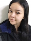 fg (forehead, zygoma), ni (fat), rhino (using donated cartilage and if more is needed ear cartilage) — Korea cost, reviews & before-after | MISOODA