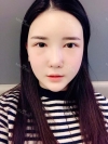 Ar + Zy + T + LP (jaw line) + thread lifting + (tack) Rhino (re) — Korea cost, reviews & before-after | MISOODA