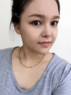 fg (forehead, zygoma), ni (fat), rhino (using donated cartilage and if more is needed ear cartilage) — Korea cost, reviews & before-after | MISOODA