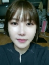 Ar + Zy (PPC) + T / adv + NI / ptosis + Rhino / lo #Free — Korea cost, reviews & before-after | MISOODA