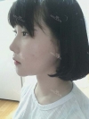 Ar + Zy (PPC) + T / adv + NI / ptosis + Rhino / lo #Free — Korea cost, reviews & before-after | MISOODA