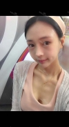 Ar + Zy + T / length extension — Korea cost, reviews & before-after | MISOODA
