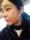 ar zy t (adv heading), fg (forehead), rhino (lo), pa (sil), aky ni (ptosis re), lat — Korea cost, reviews & before-after | MISOODA