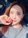 Ar + Zy + T + LP (jaw line) + thread lifting + (tack) Rhino (re) — Korea cost, reviews & before-after | MISOODA