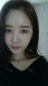 It's already been a year since I had the surgery~ — Korea cost, reviews & before-after | MISOODA