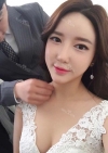 Ar + Zy + T + LP (jaw line) + thread lifting + (tack) Rhino (re) — Korea cost, reviews & before-after | MISOODA