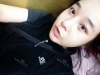ar zy t (adv heading), fg (forehead), rhino (lo), pa (sil), aky ni (ptosis re), lat — Korea cost, reviews & before-after | MISOODA
