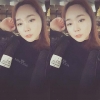 Ar + Zy + T / long hair + forehead / sil + epi + Rhino — Korea cost, reviews & before-after | MISOODA