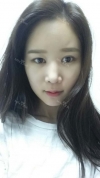 It's already been a year since I had the surgery~ — Korea cost, reviews & before-after | MISOODA