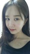 It's already been a year since I had the surgery~ — Korea cost, reviews & before-after | MISOODA